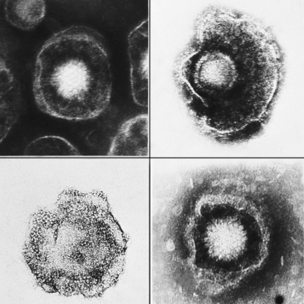 Various viruses from the Herpesviridae family seen using an electron micrograph.