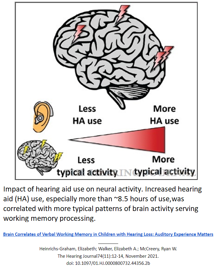 Impact of hearing aid use on neural activity
