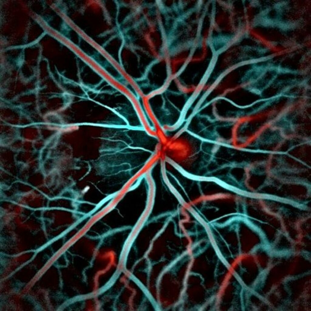 Color low-high flows of the retina taken with the laser doppler holography