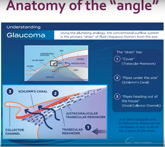 anatomy of the "angle"