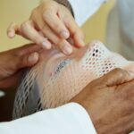 The hands of two radiation therapists are shown fitting a short face mask to a patient model to steady the head during radiation therapy.