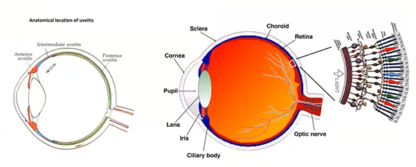 graphic illustration of the eye and uveitis