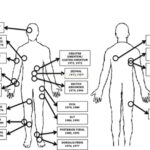 Screenshot of webinar with graphic of parts of the body used for reconstruction