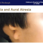 Screenshot of webinar slide that shows a boy with microtia