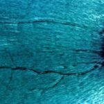 fundus with visible striations