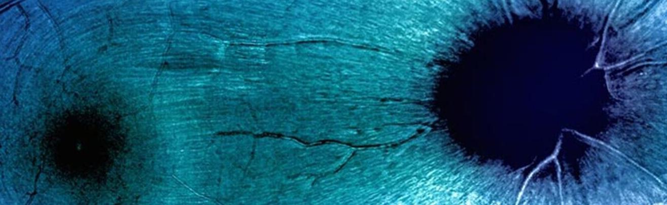 Optic Nerve Research Update - Eye &amp; Ear Foundation of Pittsburgh (via eyeandear.org)