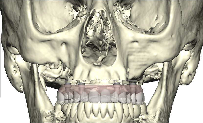 3D model