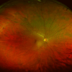 close up image of the retina