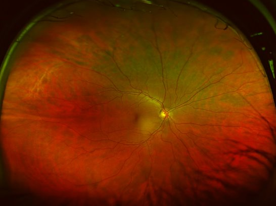 close up image of the retina