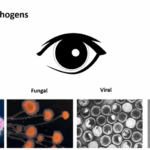 ophthalmic pathogens slide with presenters visible in upper right corner thumbnail