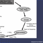 diagram of the OSA process