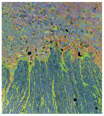 OPH image contest - Rebecca Pfeiffer - retina