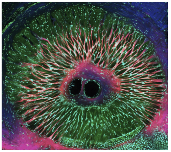 OPH image contest - Xinyue Wang - optic nerve