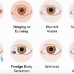 graphic of eyes displaying dry eye symptoms