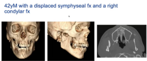 case example x-rays