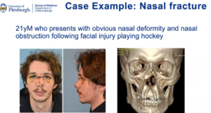 hockey player picture and x-ray