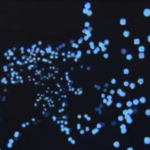 Xing Chen slide from webinar showing phosphenes