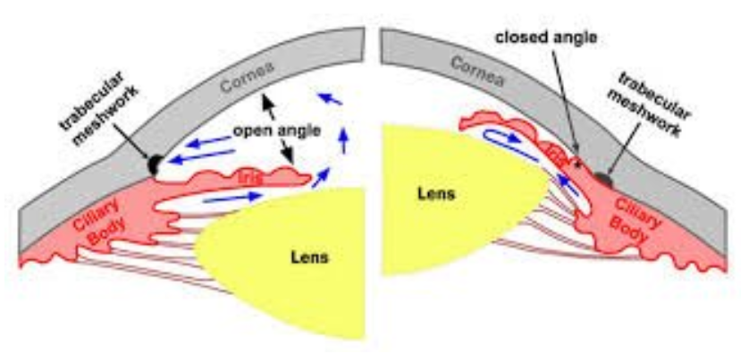 illustration of open vs closed angles